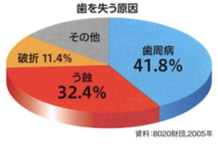 歯を失う原因